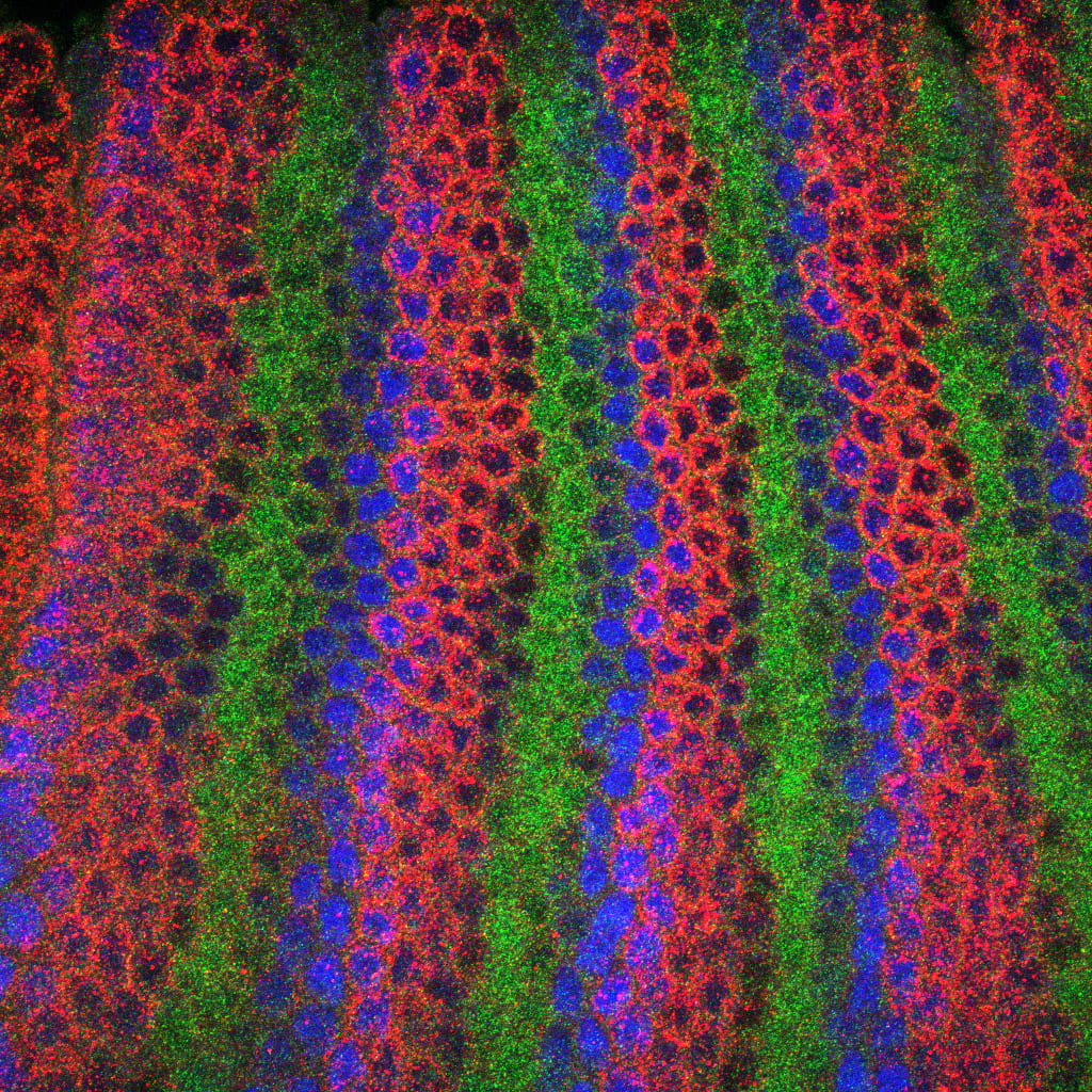 the trunk of a fruit fly embryo,