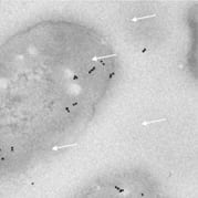 Confocal and electron microscopy images show clustered virus compartments produced by salmonella cells.